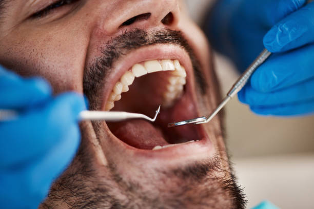 Best Chipped Tooth Repair Near Me  in Wesley Hills, NY