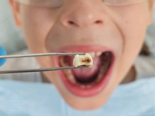 Best Broken Tooth Emergency  in Wesley Hills, NY